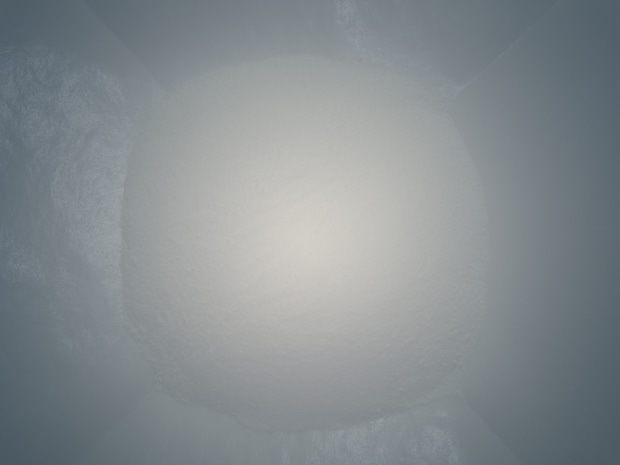 緑内障の前兆と初期症状