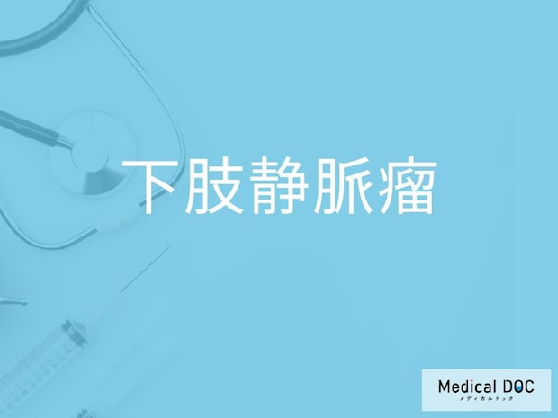 「下肢静脈瘤」の初期症状をご存じですか？ 早期発見のポイントを併せて医師が解説