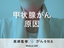 「甲状腺がんの原因」はご存知ですか？種類や治療法も解説！【医師監修】