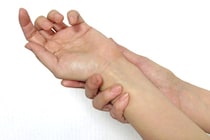 【闘病】｢皮膚筋炎｣ 筋肉に力が入らず、道端で倒れて血だらけになったことも