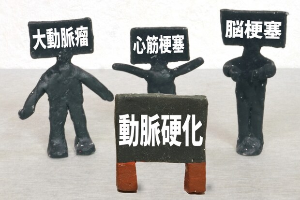 動脈硬化の原因と生じる可能性がある疾患