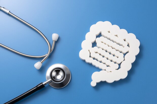 潰瘍性大腸炎の治療を詳しく知りたい！