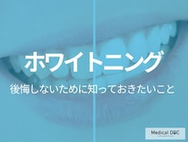 「ホワイトニング」で後悔しないために! 施術前に知らないと損するポイントを歯科医が解説!