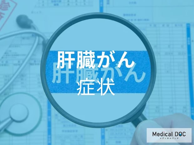 無症状でも危険? 男女問わず発症リスクのある「肝臓がん」とは【医師解説】