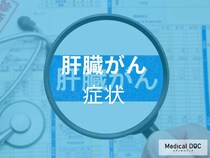 無症状でも危険? 男女問わず発症リスクのある「肝臓がん」とは【医師解説】