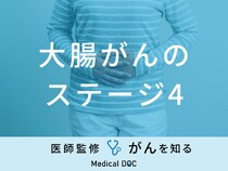 「大腸がん・ステージ4」の症状・余命はご存知ですか？医師が徹底解説！