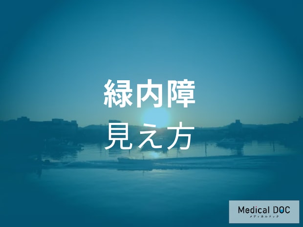 白内障との違いをご存知ですか? 「緑内障」の症状と見え方の特徴を医師に聞く