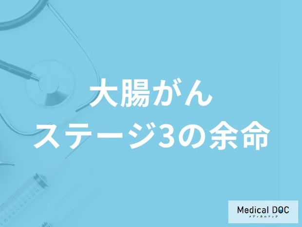 「大腸がんステージ3の余命」はご存知ですか?【医師監修】