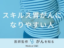 「スキルス胃がんになりやすい人」の特徴はご存知ですか？代表的な症状も解説！