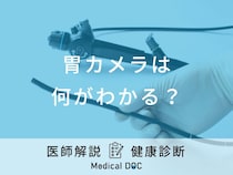 「胃カメラ」の検査方法は口からと鼻からで違う？費用や当日の流れなど医師が解説！