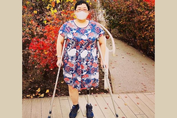 いよいよ足を切断することに。リハビリと仕事、生活の変化