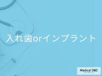入れ歯とインプラント、それぞれのメリット・デメリットを徹底比較! 【歯科医監修】