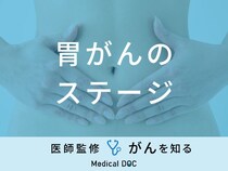 「胃がんのステージ別の症状・余命・生存率」はご存知ですか？医師が解説！