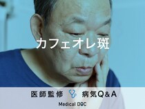 「カフェオレ斑（茶色のあざ）」ができる原因はご存知ですか？医師が監修！