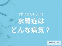 「水腎症」を発症すると現れる症状はご存知ですか？原因についても解説！
