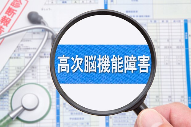 高次機能障害の影響で、やる気が起きない