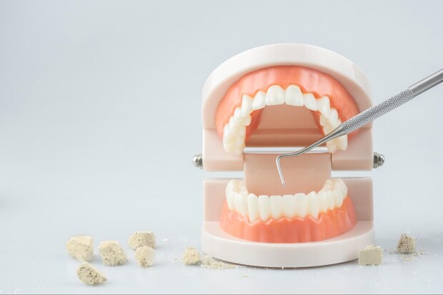 歯周病の症状と原因