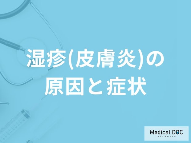 「湿疹（皮膚炎）」を発症すると現れる症状・原因はご存知ですか？【医師監修】