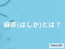 「麻疹(はしか)」の症状・原因はご存知ですか？【医師監修】