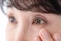 ｢緑内障｣を眼科医が基礎から解説 白内障との違いは? 症状･治療･手術について知る