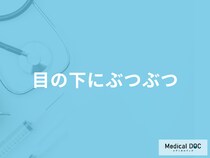 「目の下にぶつぶつ」ができる原因はご存じですか？考えられる病気も医師が徹底解説