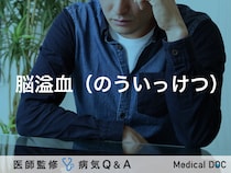 「脳溢血（のういっけつ）」とは？治療法・前兆・原因についても解説！