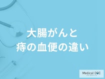 「大腸がんと痔の血便の違い」はご存知ですか？医師が監修！