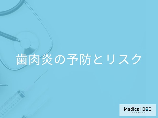 歯肉炎の予防とリスク