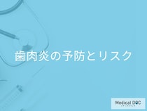 歯肉炎の予防とリスク