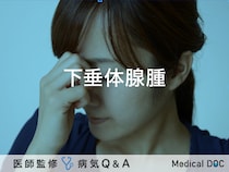 「下垂体腺腫（かすいたいせんしゅ）」とは？症状・原因・治療法も解説！