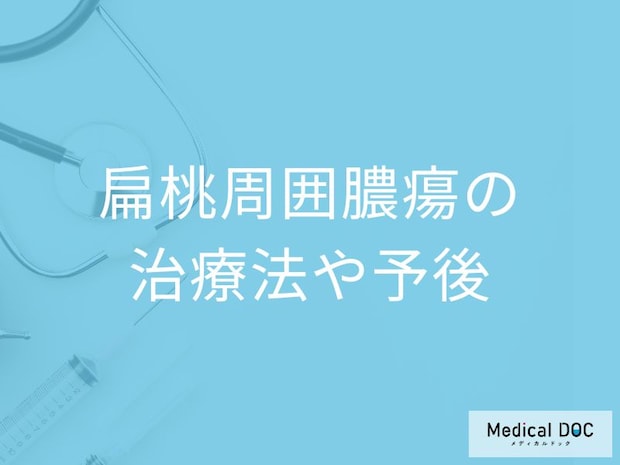 「扁桃周囲膿瘍」が治るのにはどのくらいかかる？治療法・予防法を医師が解説！