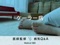 「ケーラー病」になると現れる症状はご存知ですか？