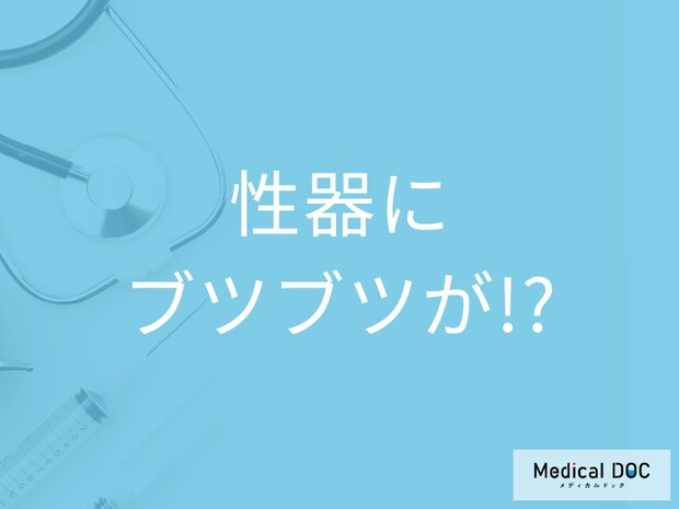 「尖圭コンジローマの原因・症状」を薬剤師が解説 どのような感染経路が考えられる？