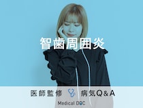 「智歯周囲炎」の原因・発症しやすい年齢層はご存知ですか？医師が監修！