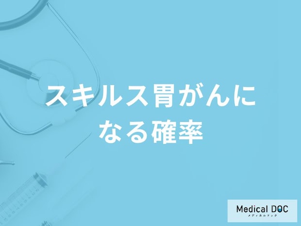 「スキルス胃がんになる確率が高い人」の4つの特徴はご存知ですか？【医師監修】