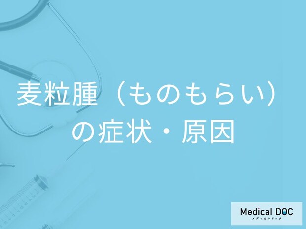 「ものもらいの初期症状」はご存じですか？なりやすい人の特徴も医師が解説！