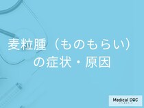 「ものもらいの初期症状」はご存じですか？なりやすい人の特徴も医師が解説！