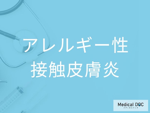 「アレルギー性接触皮膚炎」の初期症状を医師が解説 かゆみ・赤みが出る仕組みとは