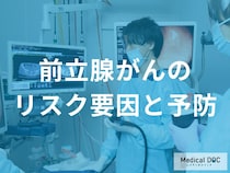 50歳からの新習慣! 「前立腺がん」を予防する食事と定期検査を受けるべき人の特徴