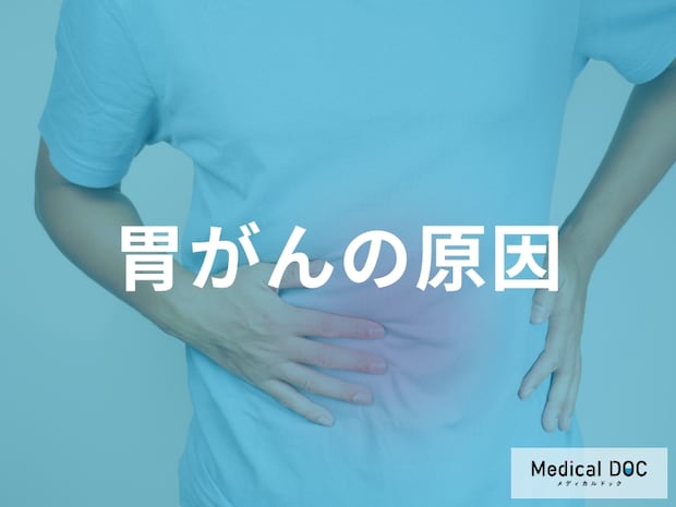 「胃がん」発症の主な原因は何が考えられる?【医師監修】