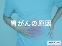 「胃がん」発症の主な原因は何が考えられる？【医師監修】