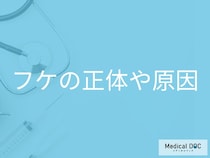 フケの原因は頭皮の「カビ」だった？脂漏性皮膚炎の症状と対処法を医師が解説