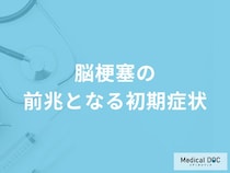 「脳梗塞の前兆となる4つの初期症状」はご存知ですか？【医師解説】