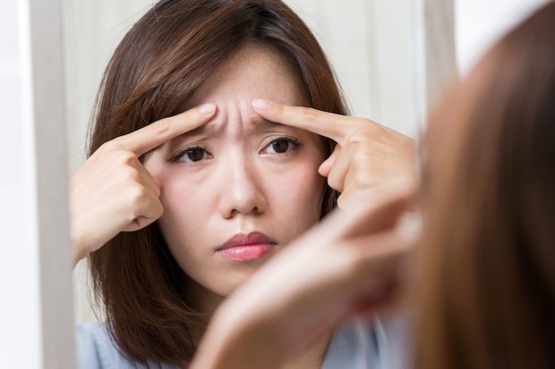 「眉間のしわにボトックス」は有効なのか? 表情が不自然になるリスクと対策を医師が解説