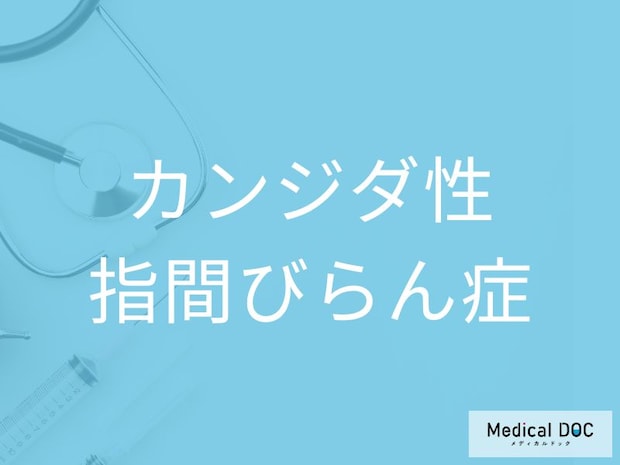 「カンジダ性指間びらん症」の原因を医師が解説 水仕事と真菌（カンジダ）の関係とは？