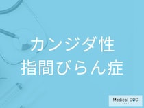 「カンジダ性指間びらん症」の原因を医師が解説 水仕事と真菌（カンジダ）の関係とは？