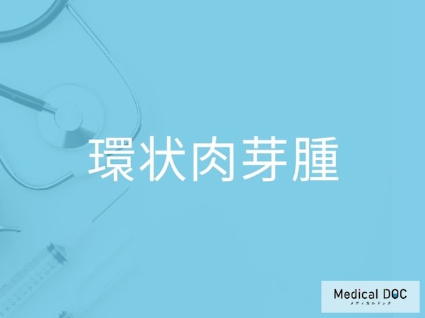 かゆみが少ない皮疹は「環状肉芽腫」のサイン？ 特徴と経過観察の重要性を医師が解説