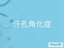 “皮膚がん”に移行することも？ 「汗孔角化症」の経過観察が重要な理由とは【医師監修】