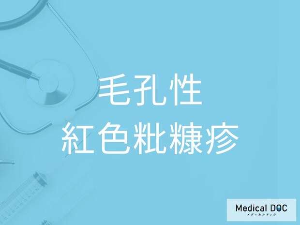 「毛孔性紅色粃糠疹」の初期症状を医師が解説 毛穴の赤みや角化の特徴とは