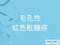 「毛孔性紅色粃糠疹」の初期症状を医師が解説 毛穴の赤みや角化の特徴とは
